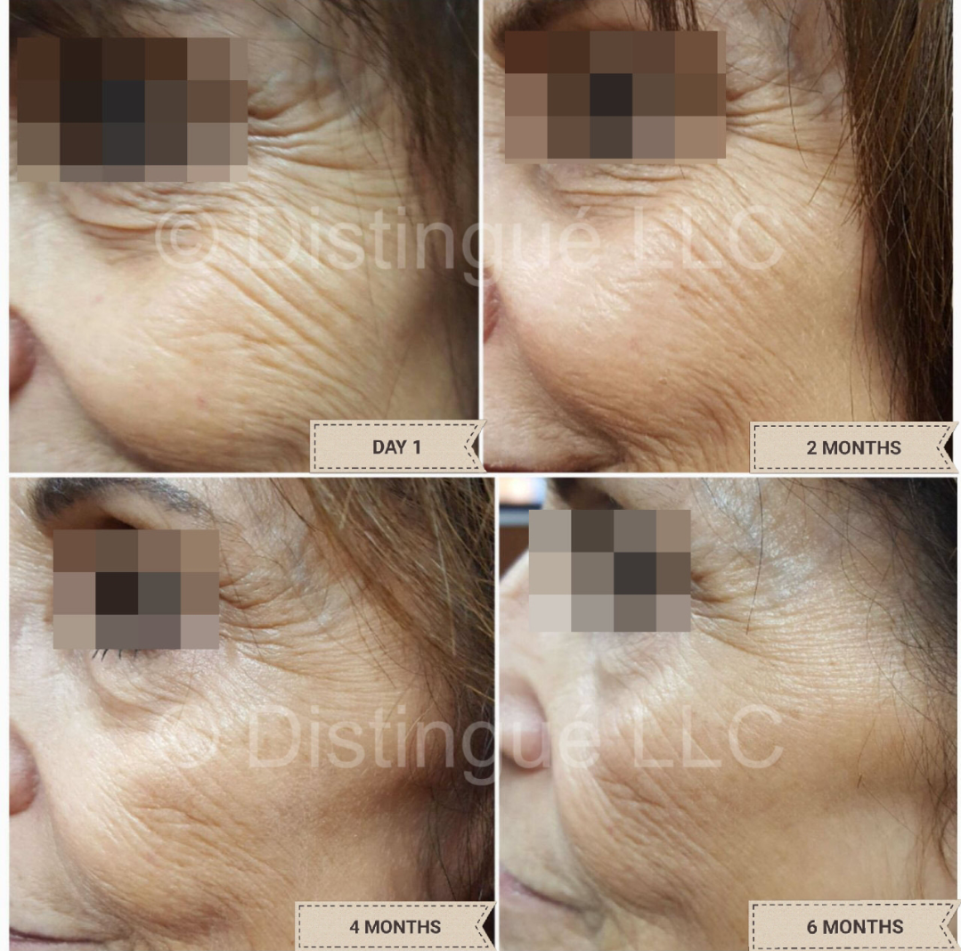 Marvesol® Anti-Aging cream