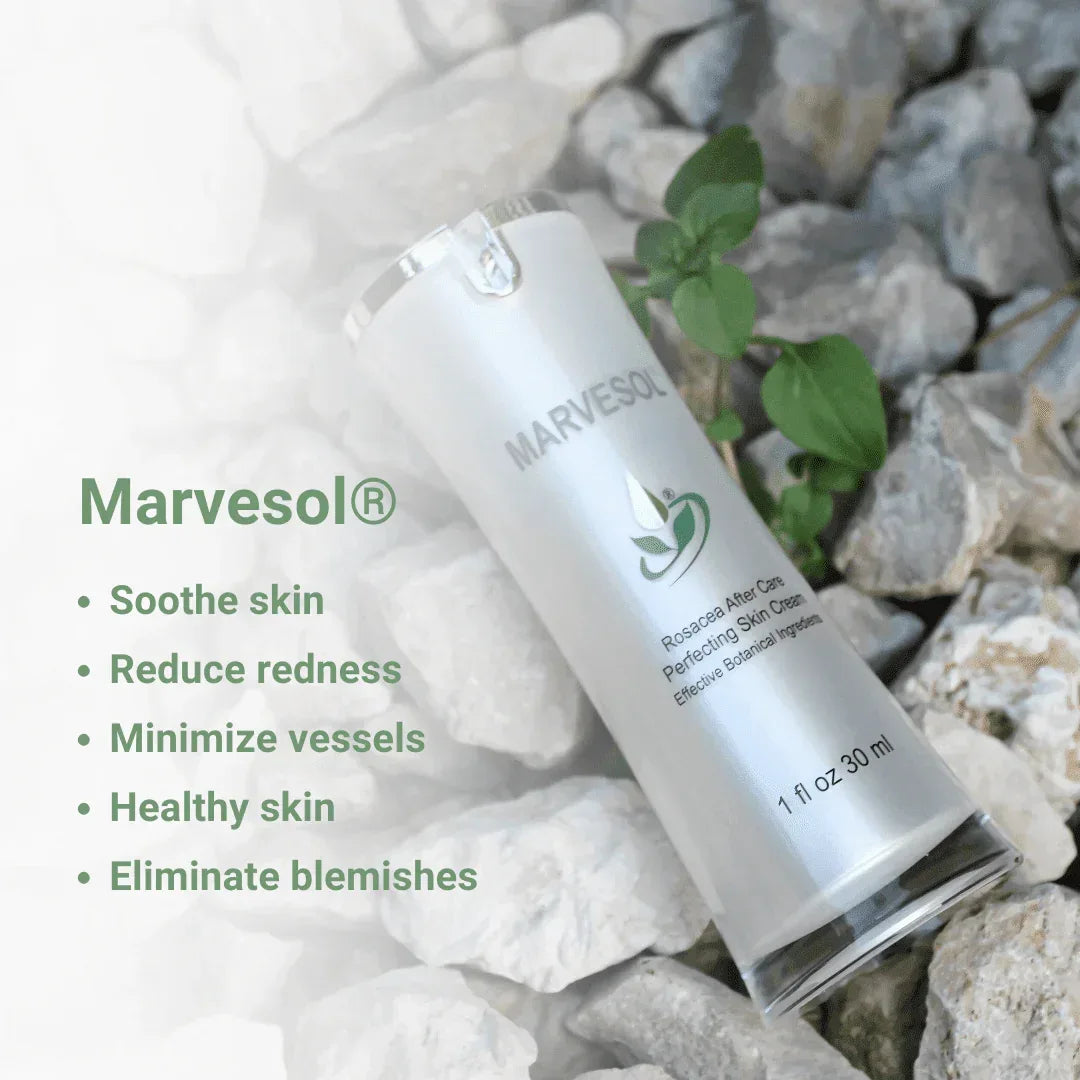 Best Moisturizer for Rosacea Relief-Marvesol Cream - Marvesol®