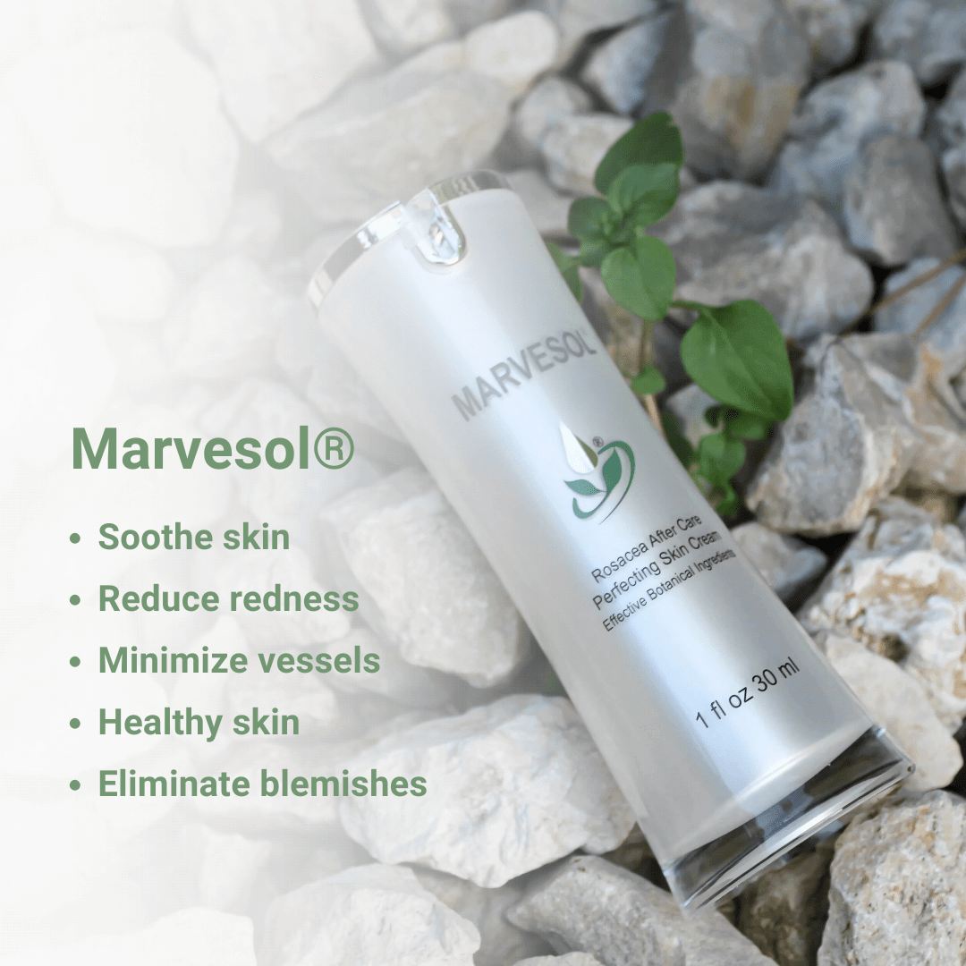 Marvesol cream bottle labeled as the best moisturizer for rosacea placed on white and gray stones with green plant