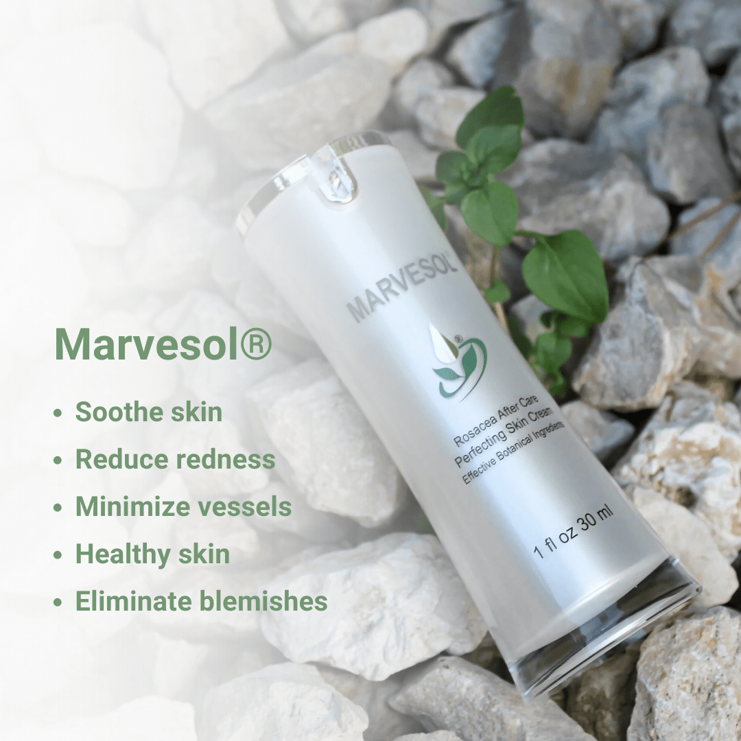 Marvesol® Rosacea After Care Cream - Marvesol®